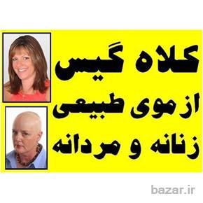 فروش سفارشی کلاه گیس زنانه و کلاه گیس مردانه فقط با موهای طبیعی انسان برای خانم ها و اقایان