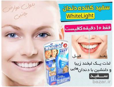 دستگاه سفید کننده دندان وایت لایت اصل